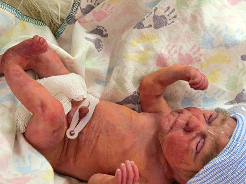 Micro preemie full - micro,